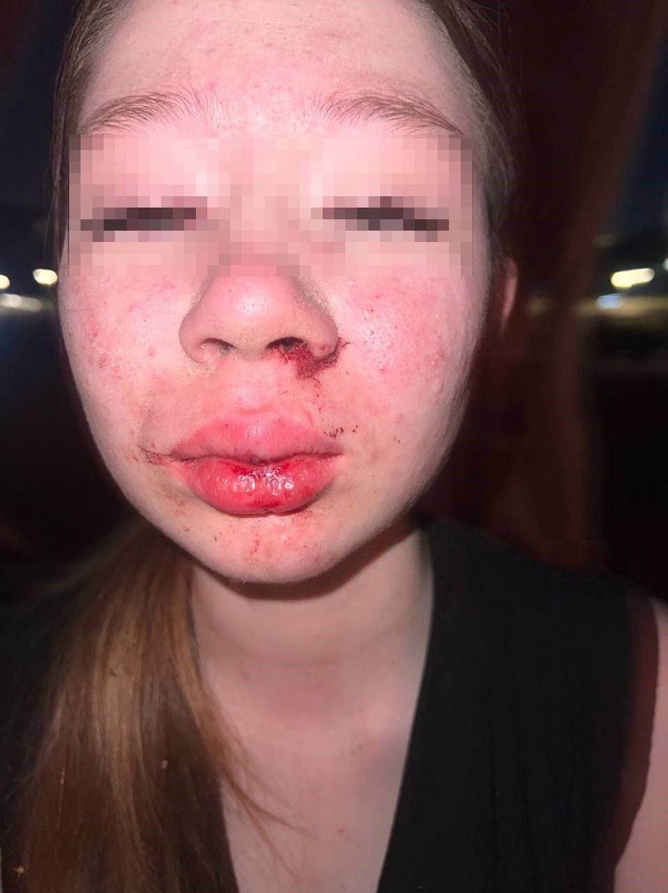 17-летнюю жительницу Нижнего Новгорода изнасиловали на набережной Гребного канала