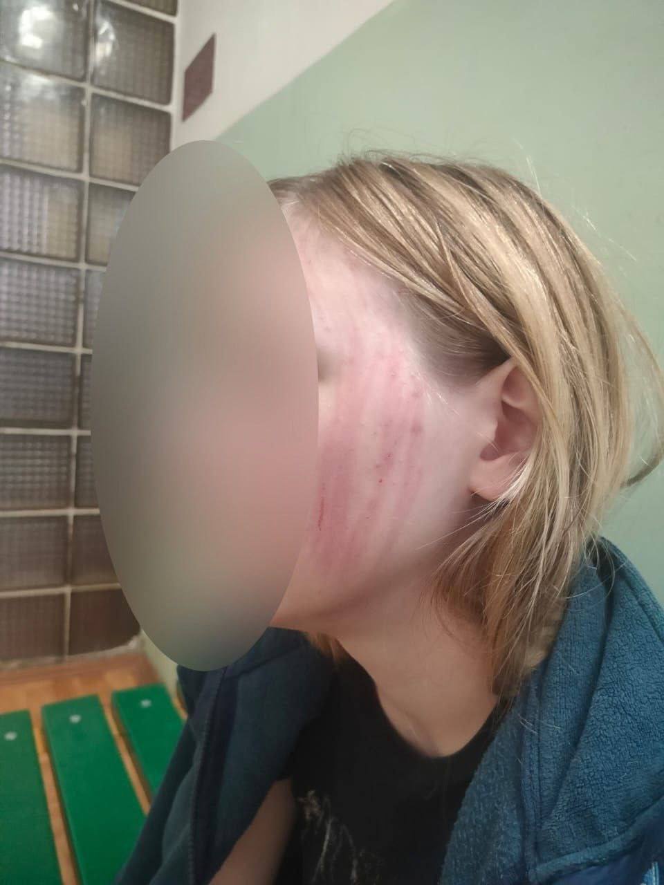 В Тверской области водитель избил и выгнал из автобуса девочку-подростка