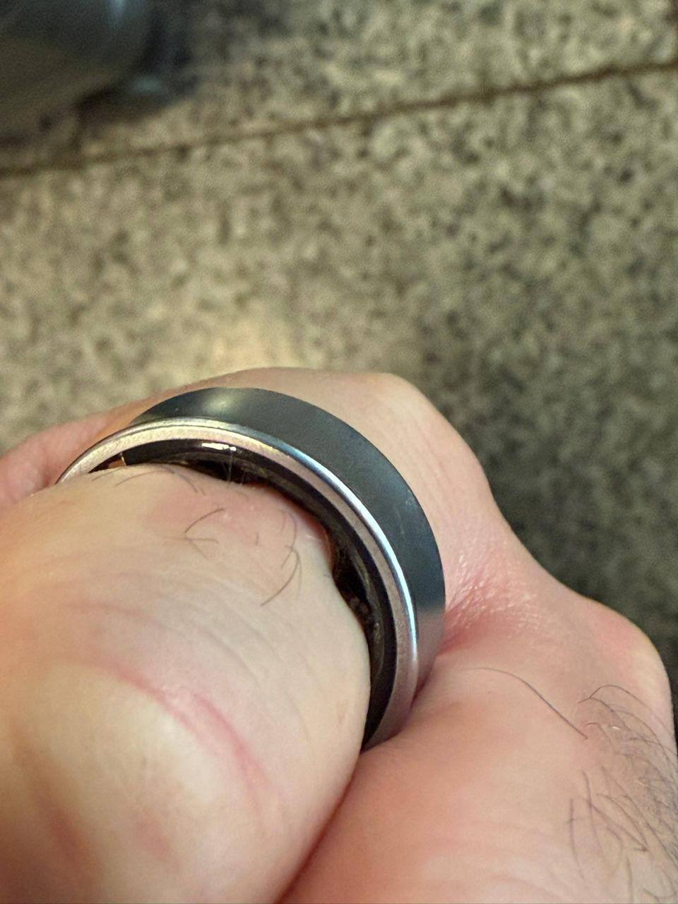 Айтишник чуть не лишился пальца из‑за Samsung Ring.