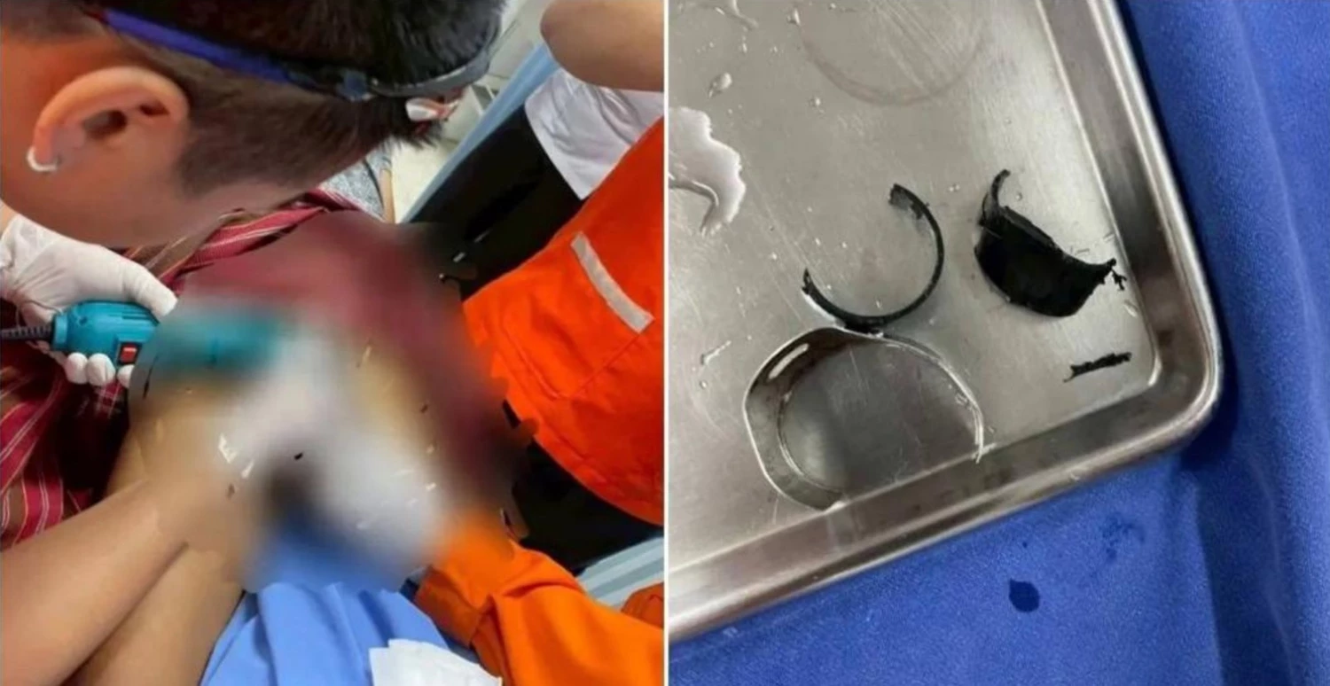 В Таиланде мужчина попытался защитить своё достоинство металлическими кольцами