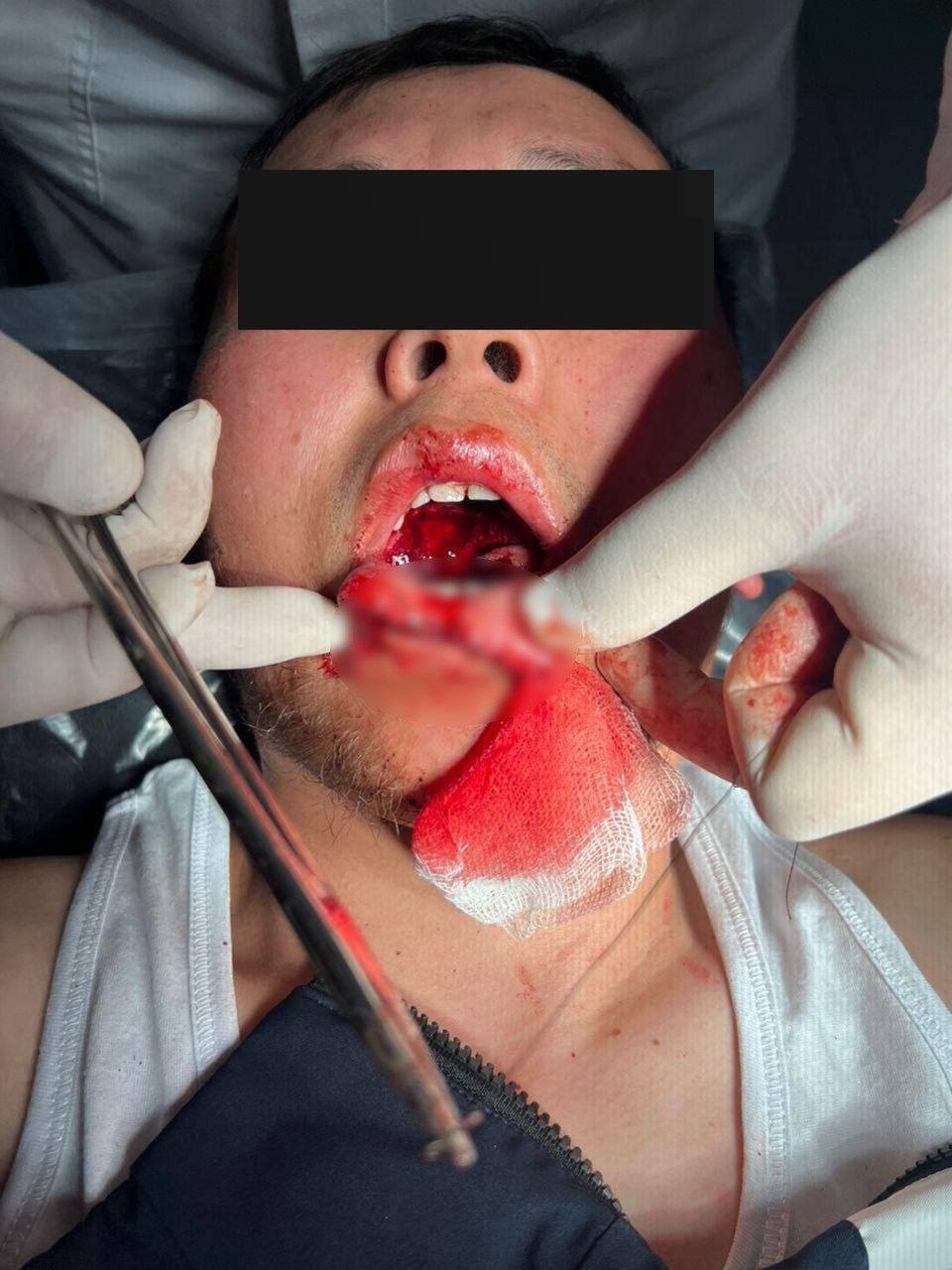 В Кыргызстане девушка откусила парню язык в попытке её изнасиловать