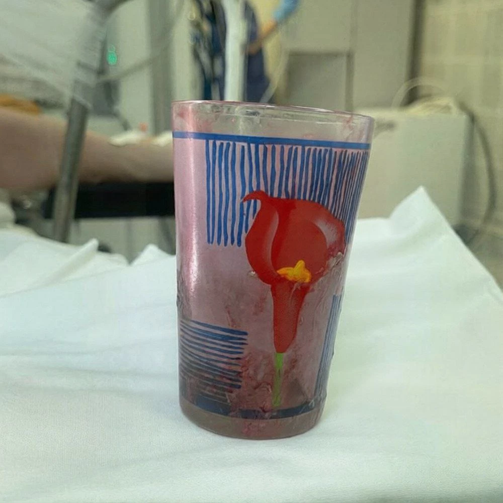 Уфимец праздновал 23 февраля и сел жопой на стакан — скорая + больница + позор на весь город