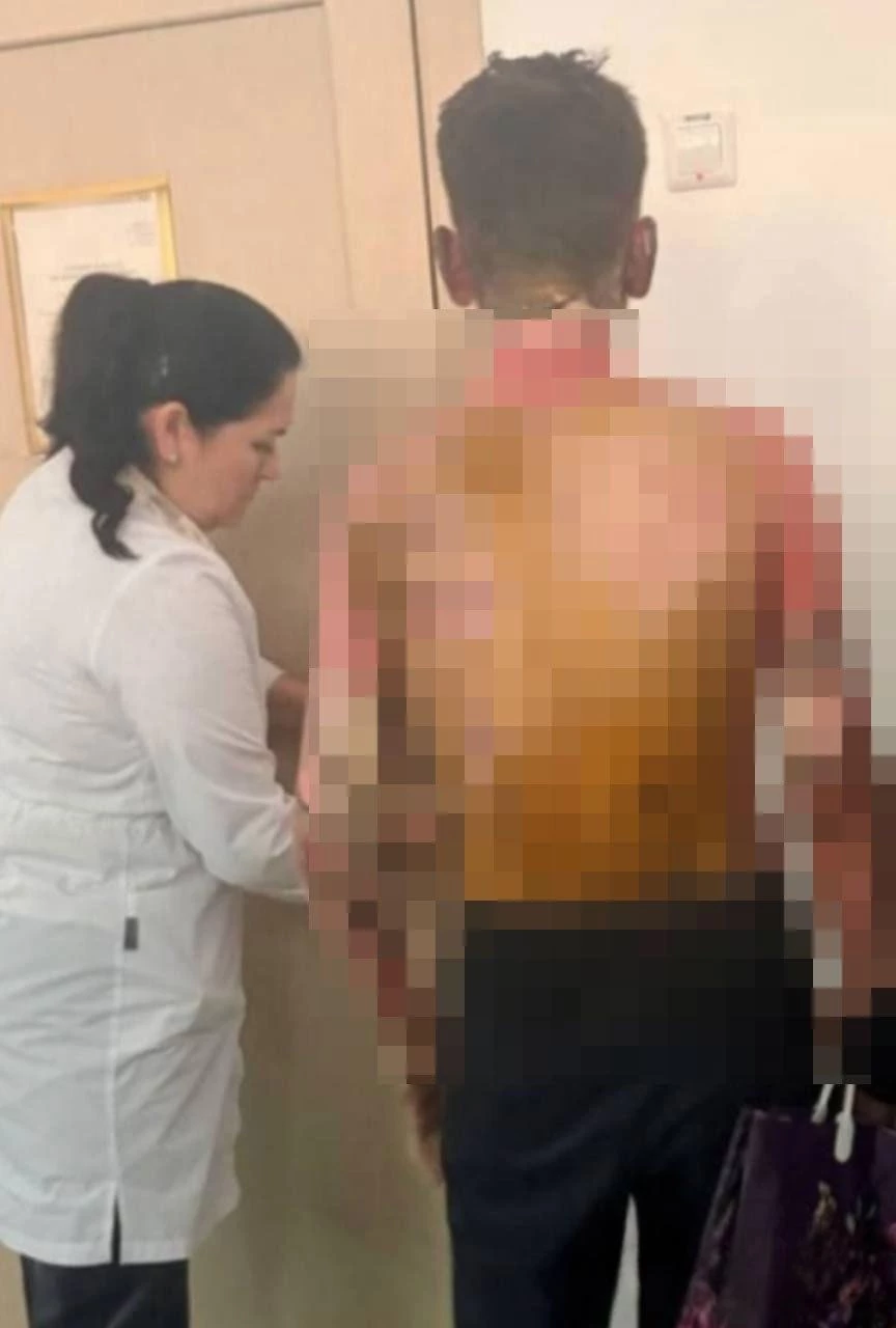 14-летняя школьница в Красноярске облила бензином и подожгла одноклассника