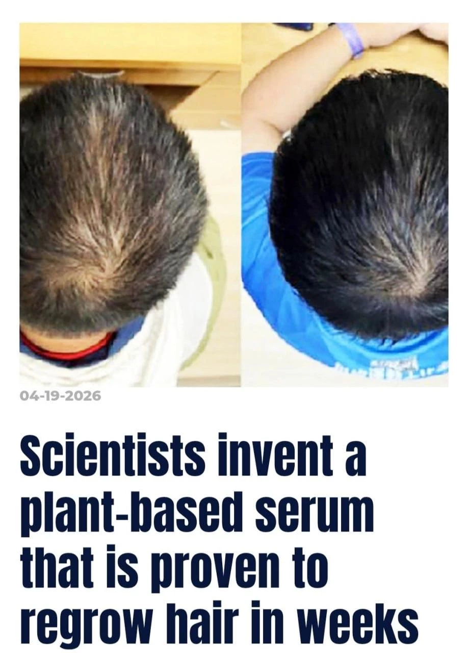 Китайские учёные создали сыворотку, которая реально лечит облысение