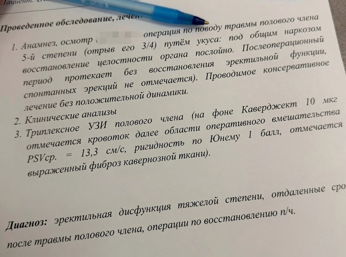 Москвичка заточила зубы напильников, чтобы откусить член мужу.
