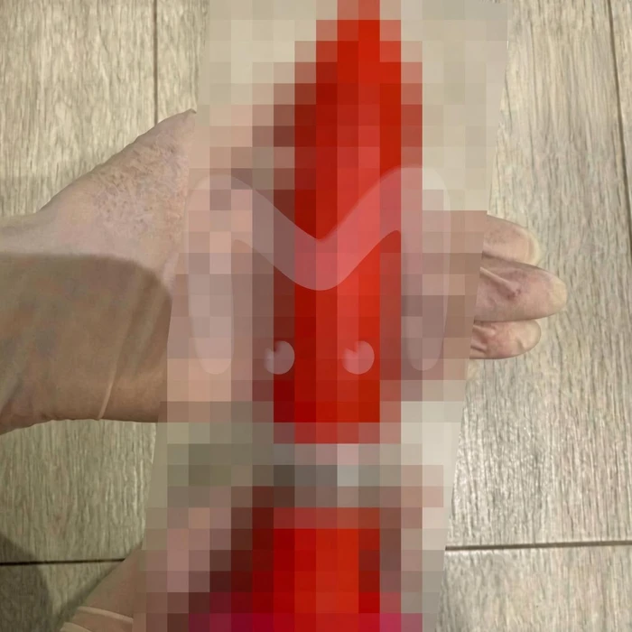 ChatGPT довел уфимца до больнице
