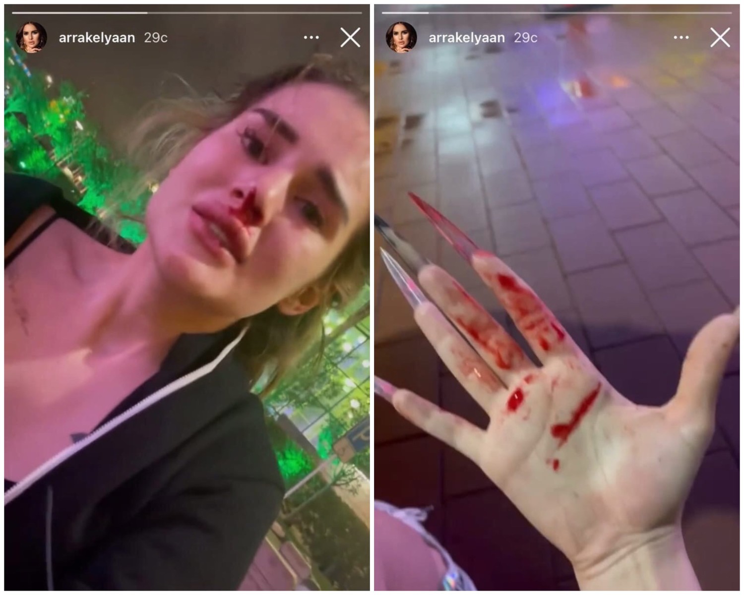 Кадр из новости Карину Аракелян ударил до крови ее же парень