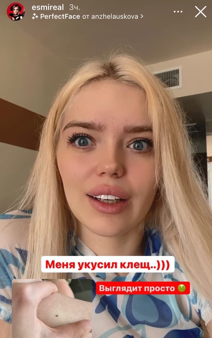 В Мексике Эсми «поймала» клеща