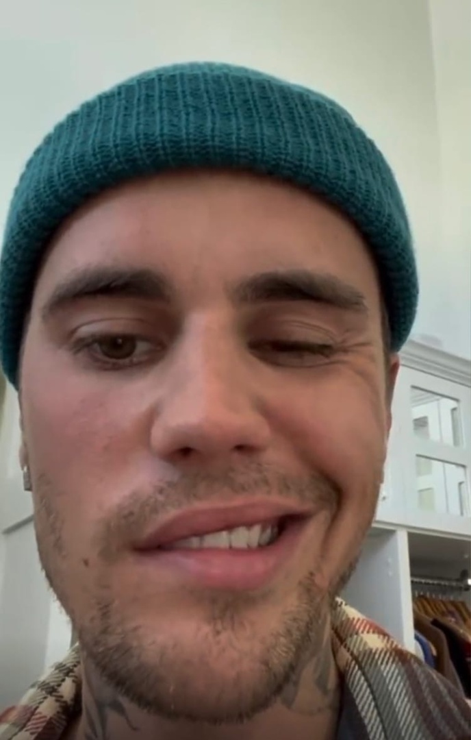 Джастину Биберу парализовало половину лица