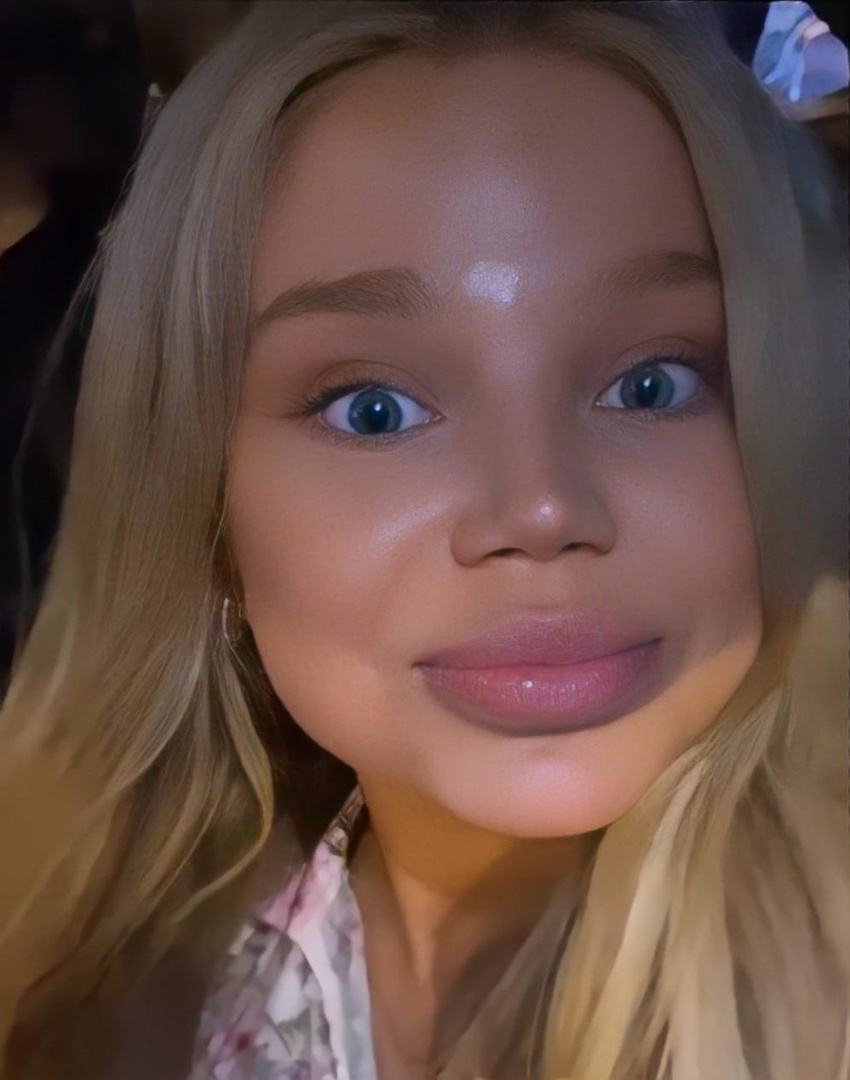 Фанаты Вероники Золотовой не оценили ее ринопластику