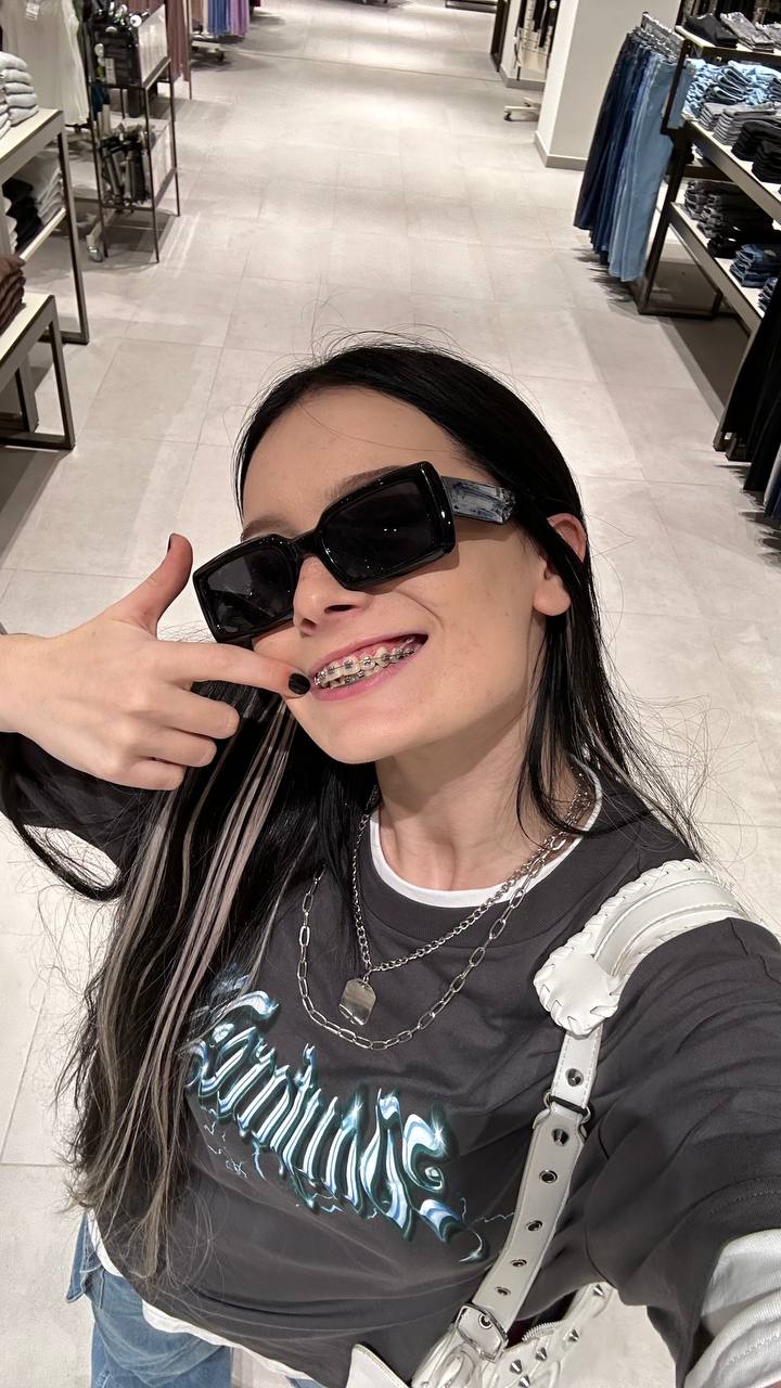 Дашу Дошик хейтят за кожу