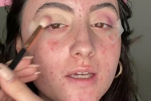 Кадр из новости Блогерше Лавинии Русанде известно, каким способом скрывать прыщи, делая макияж