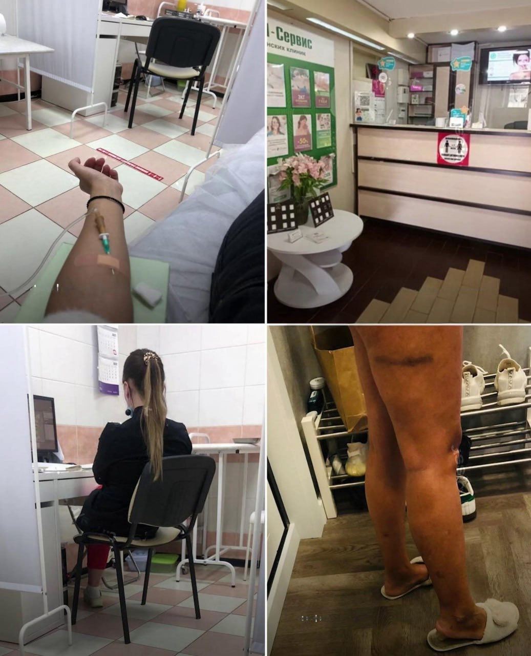 Удалила половые губы ради парня, который в последствие её бросил