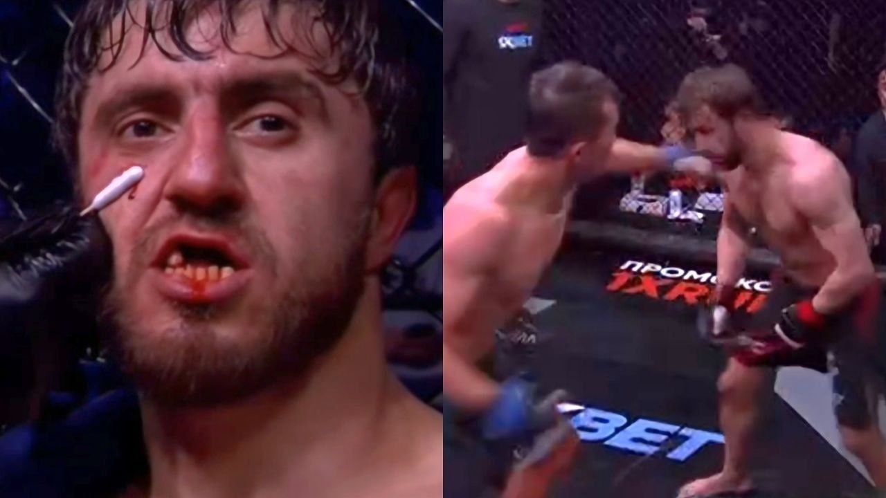 Мурад «Легенда» потерял зубы в бою лиги RFC.