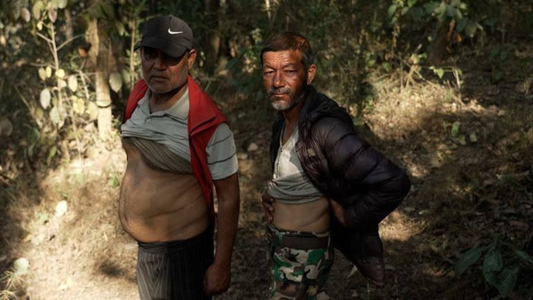 В Непале обманным путем получают почки