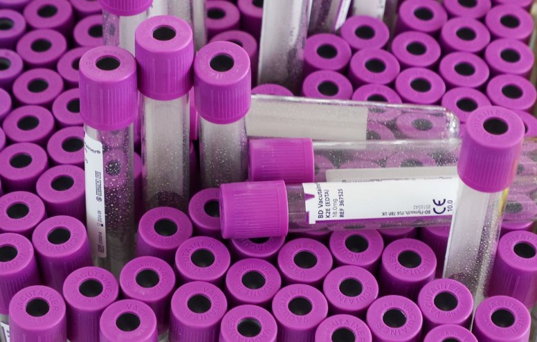 Число новых случаев сифилиса в Москве выросло в три раза с 2019 года